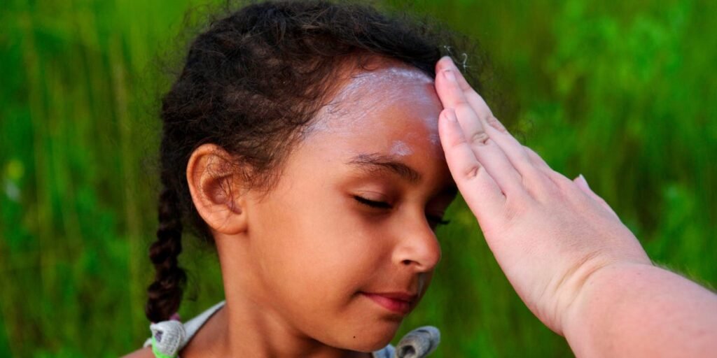 Wear Sunscreen During the Total Solar Eclipse; Here’s Why