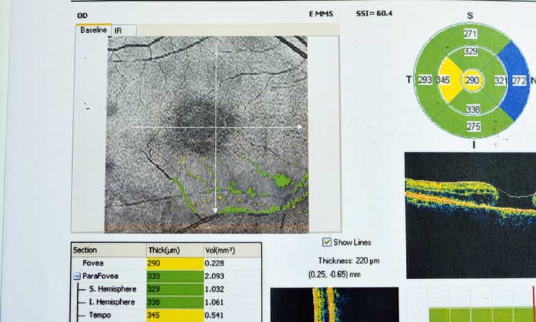 4D Molecular, FDA agree on phase 3 design for DME candidate