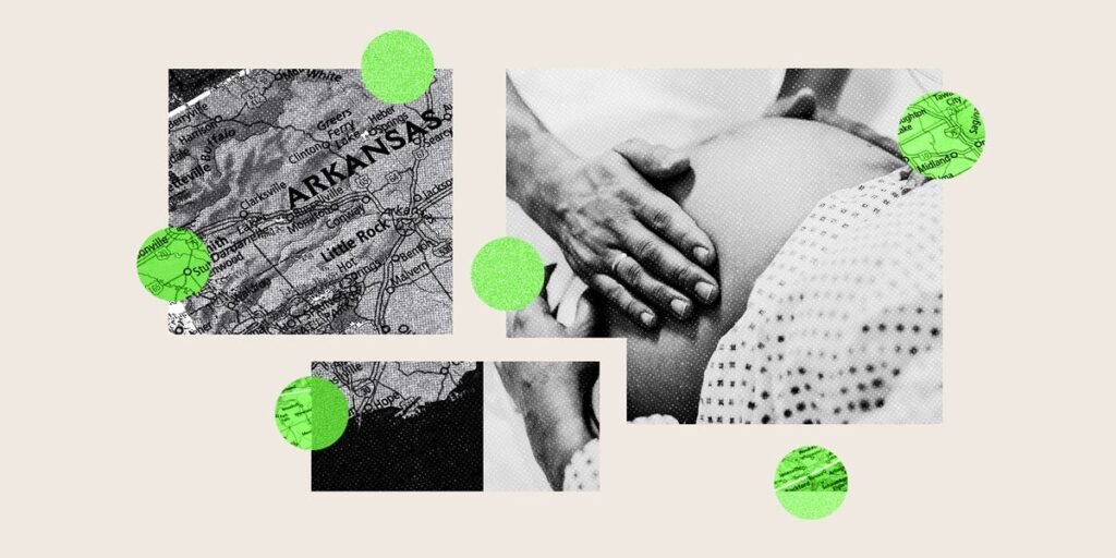 Hospital C-Section Rates Vary Widely. Women Often Can’t See the Data.