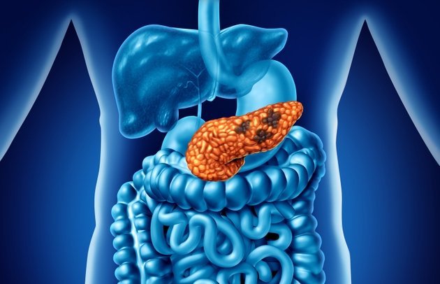Immuneering plummets following phase 2 data of atebimetinib for pancreatic cancer